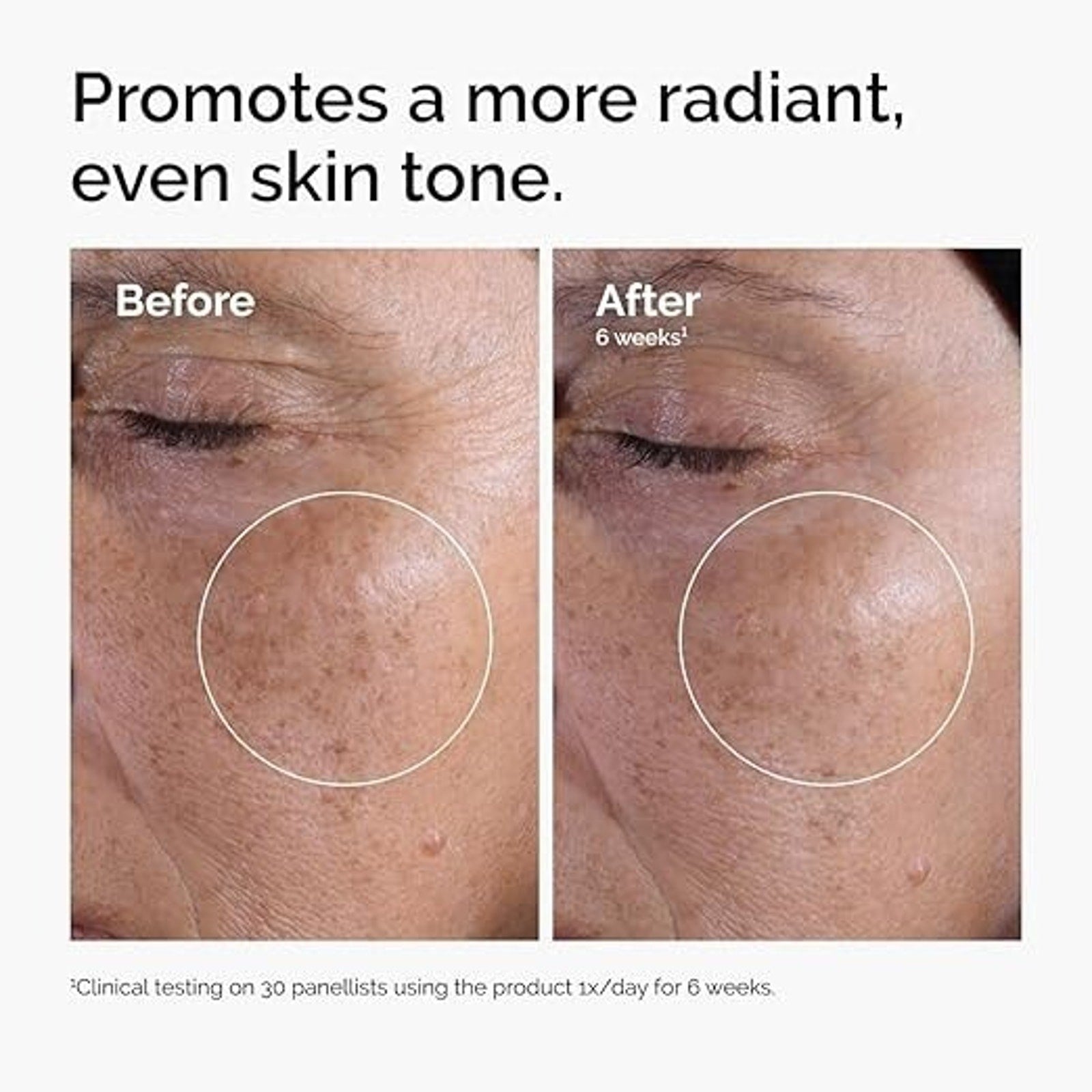 The Glycolic Acid 7% Toning Resurfacing Solution New 8oz Authentic